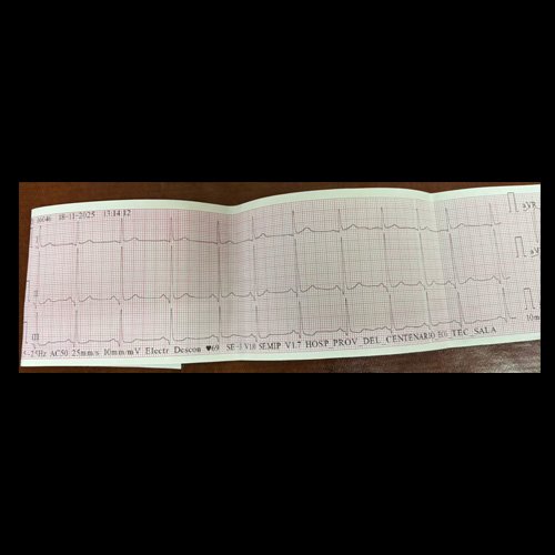  Electrocardiograma Día 1