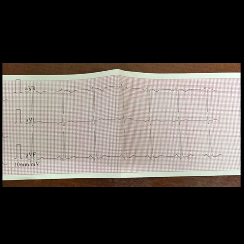  Electrocardiograma Día 1