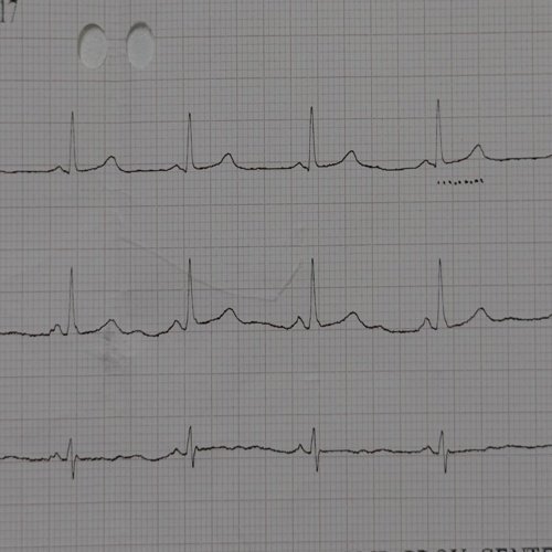 Maternidad en diálisis: un desafío para el médico clínico.